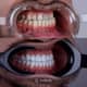Slider image (9) Aesthetic Dental Care Costa Rica